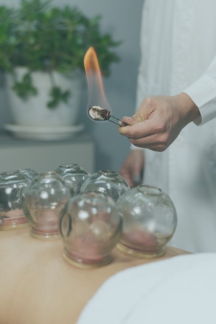 cupping fire